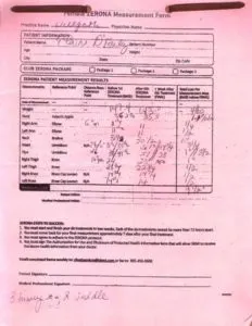 Zerona laser treatment measurements for body contouring results