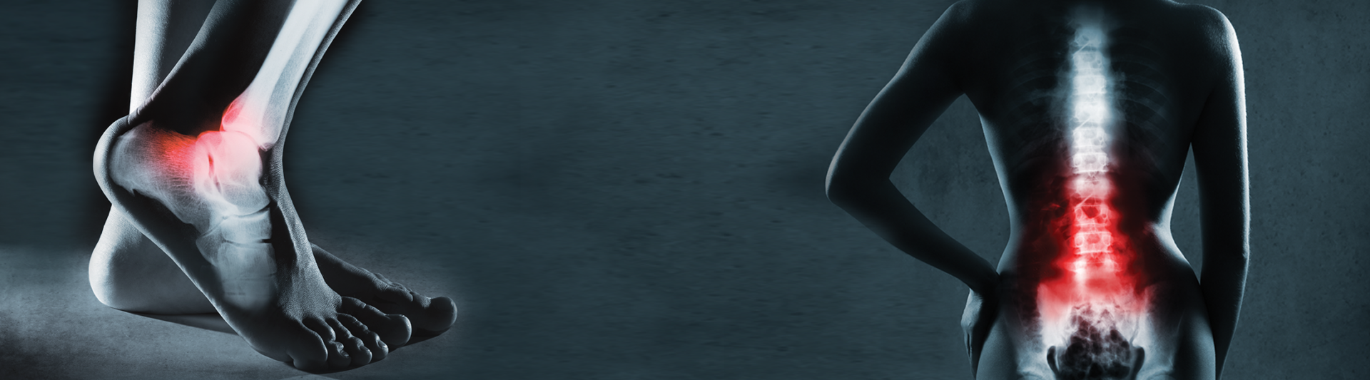 Erchonia Manufacturer Of Lasers For Pain Relief & Treatment