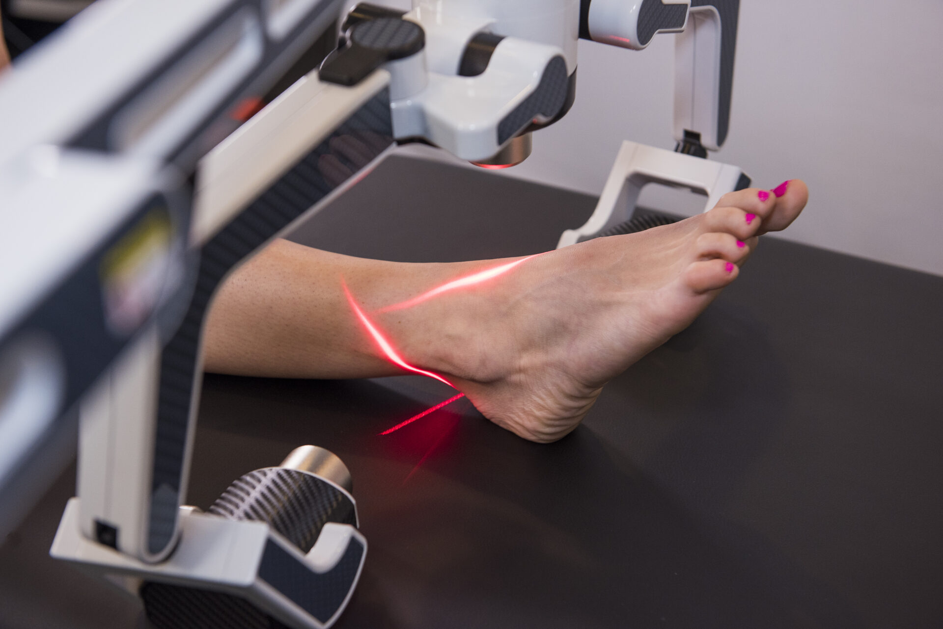 An FX 635 scanner treating a patient’s heel