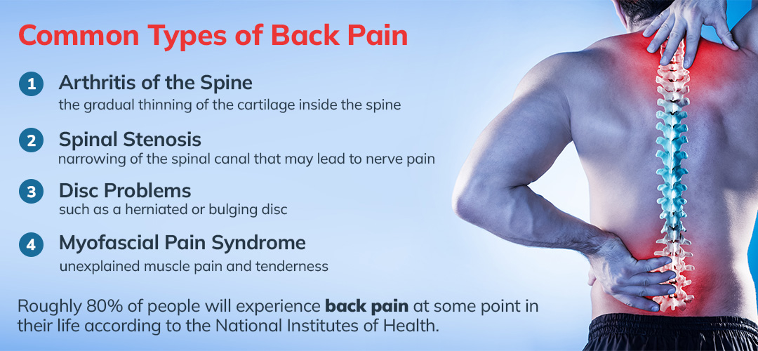 common types of back pain