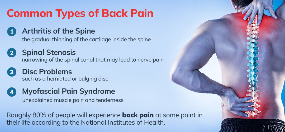 Best Ways to Treat Chronic Back Pain Without Surgery