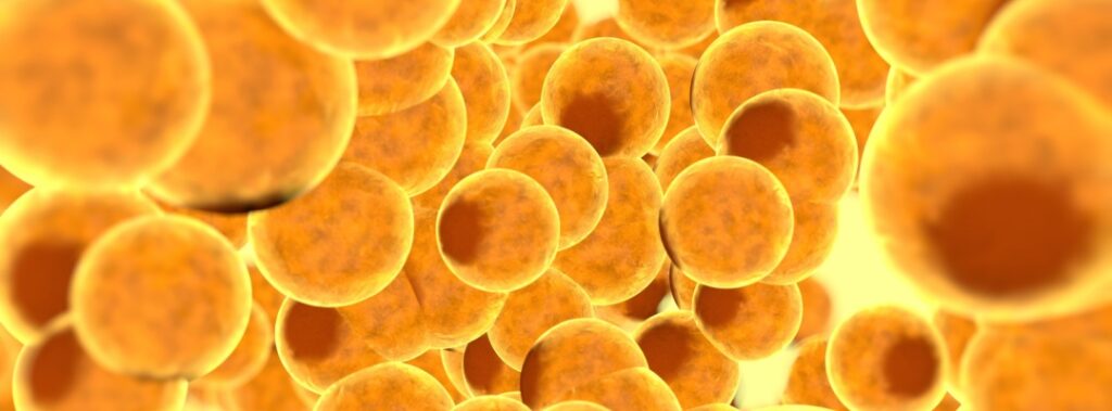 Understanding Fat Cell Survival After Green Wavelength Treatment