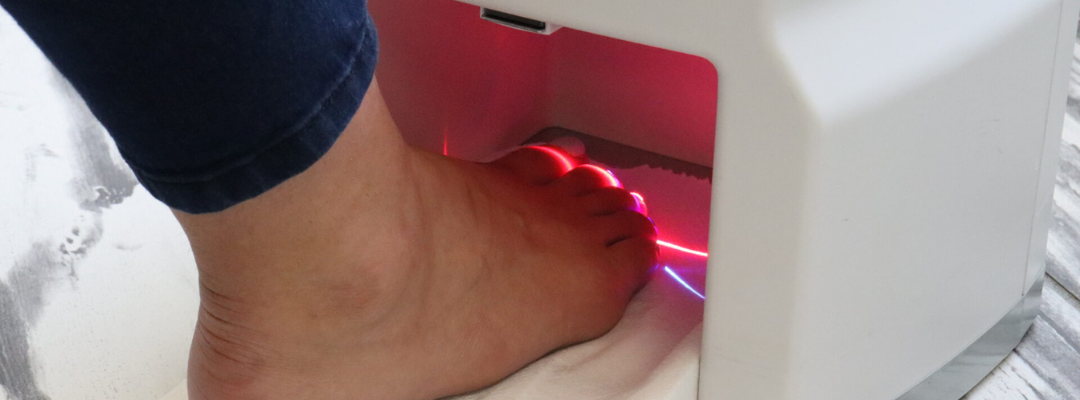 Person Using Erchonia Lunula Laser® for Nail Fungus Treatment