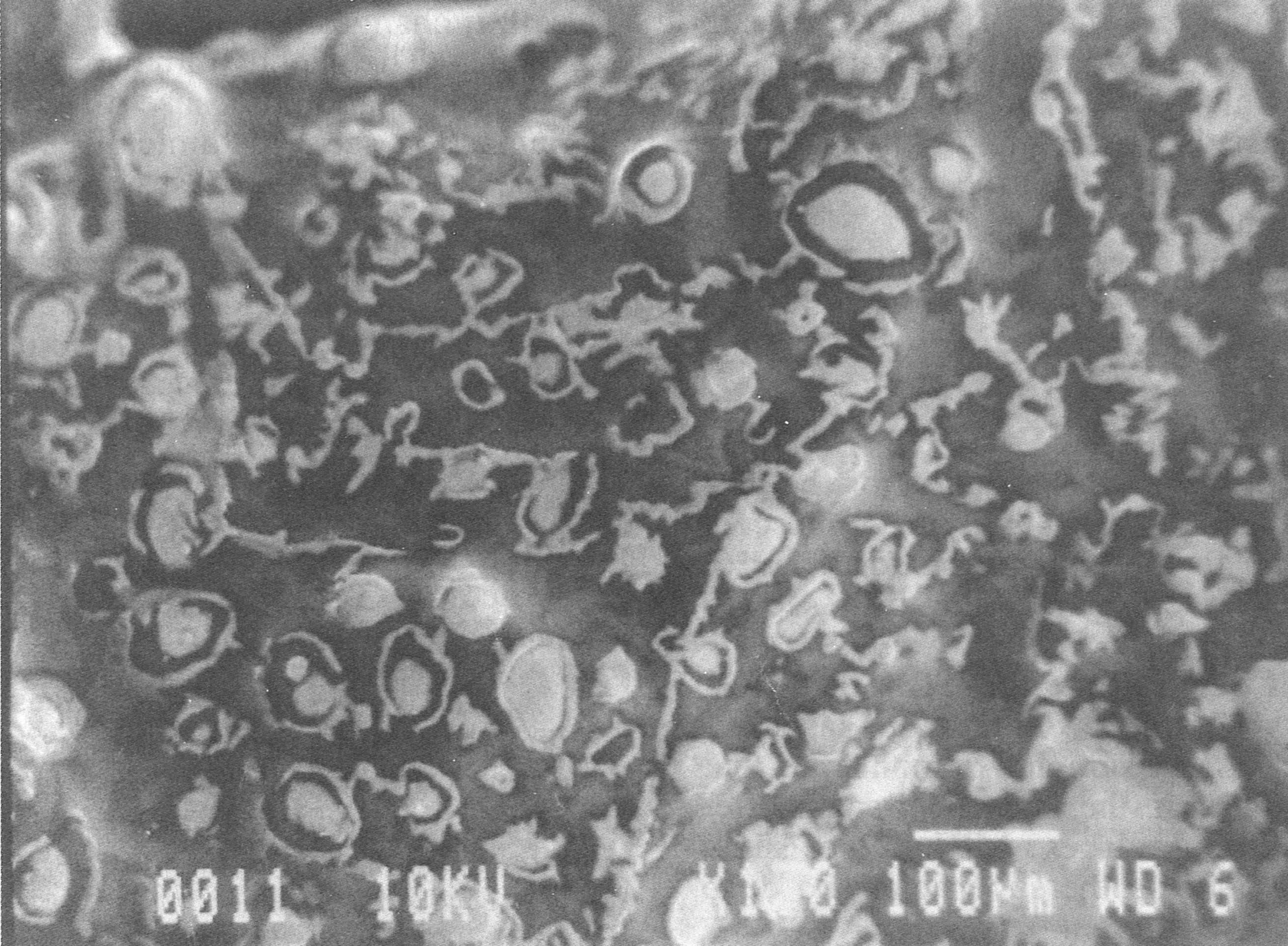 12 minutes — adipose cells collapsing
