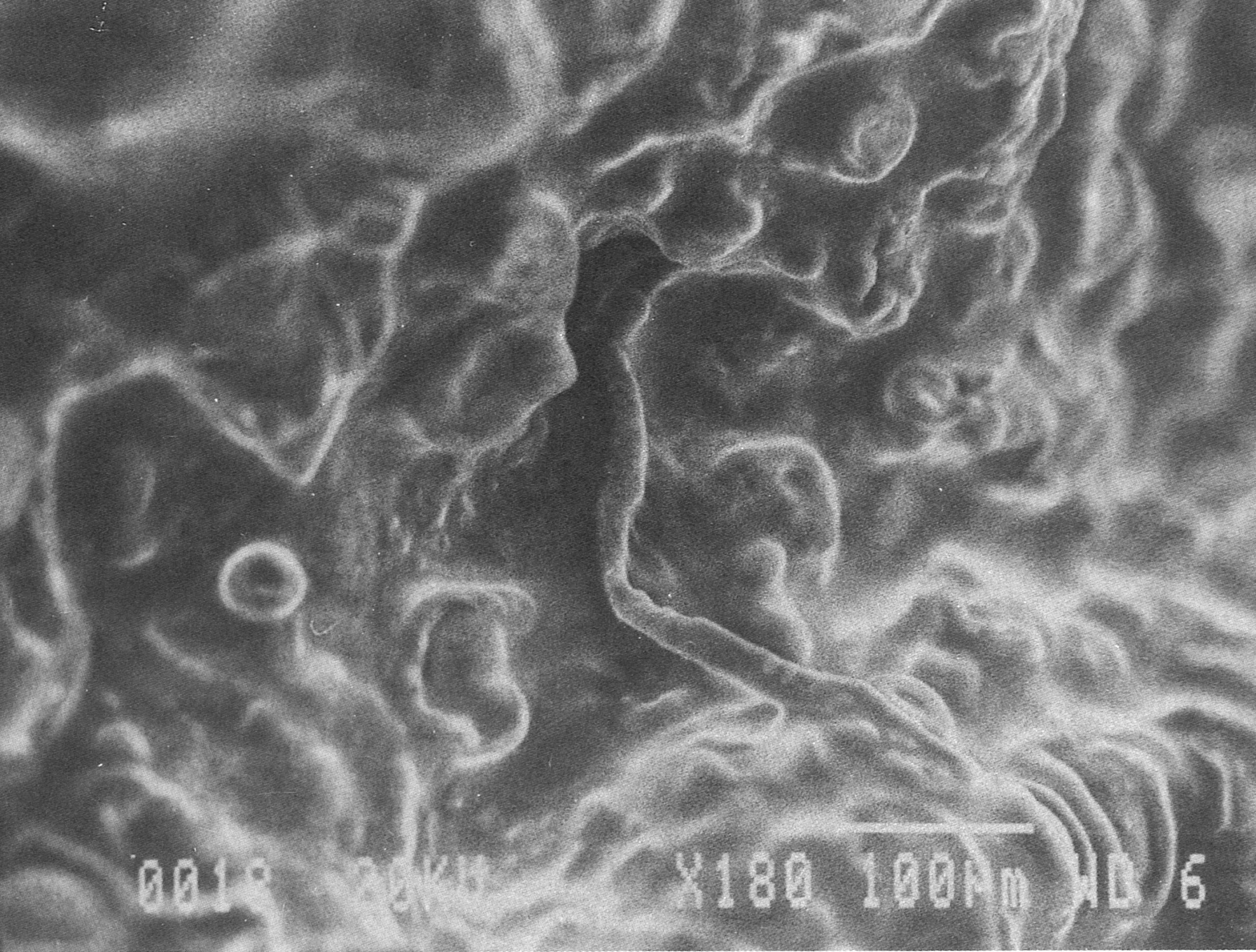 18 minutes — empty, collapsed adipose cells