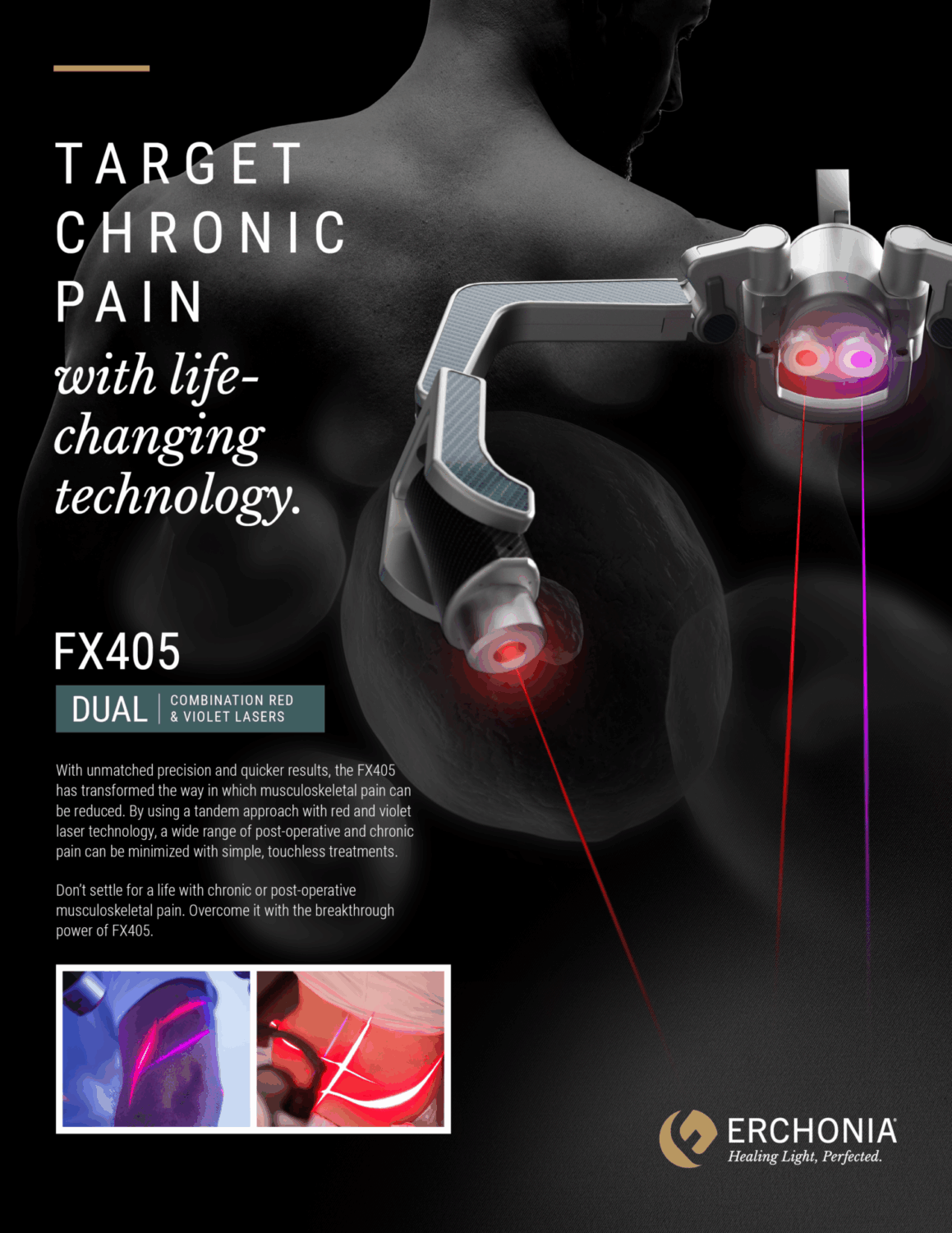 FX405_pain