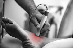 Clinician applying low-level laser therapy to a patient's heel for non-opioid chronic pain relief