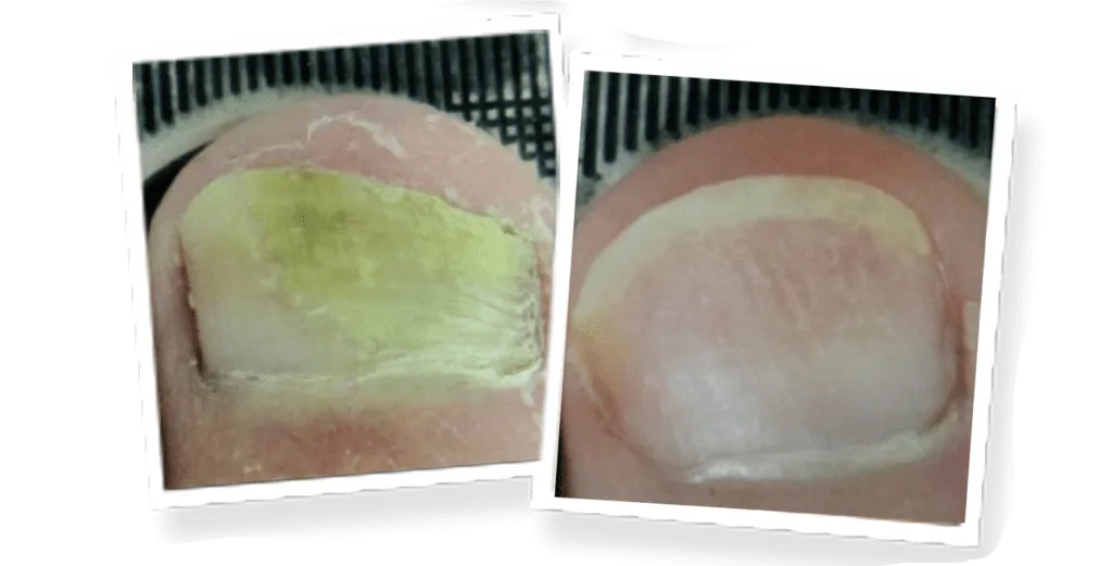 Before and after — case 1