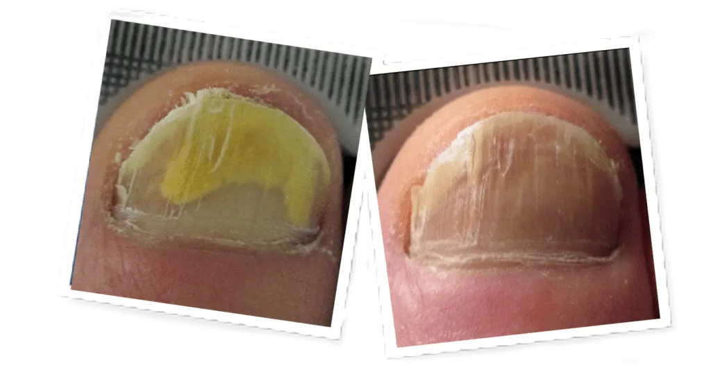 Before and after — case 2