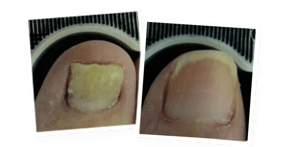 Before and after — case 3