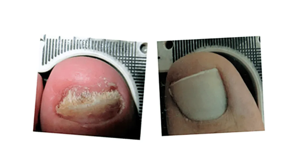 Before and after — case 4