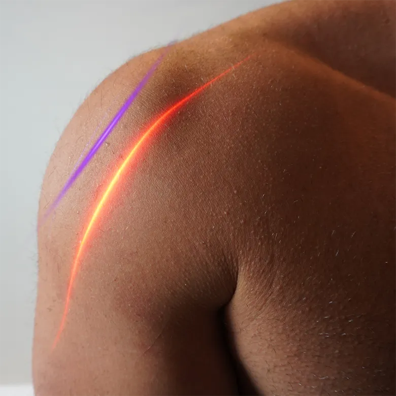EVRL Laser