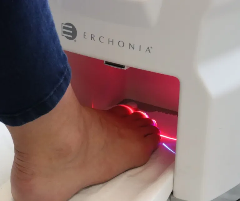 Onychomycosis