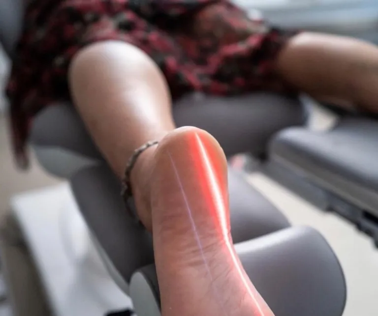 Laser Plantar Fasciitis
