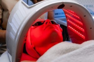 Red light helmet delivering transcranial photobiomodulation treatment