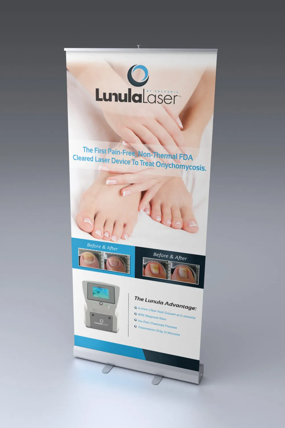 Lunula_Pull-up-Banner-03-Print_Mockup