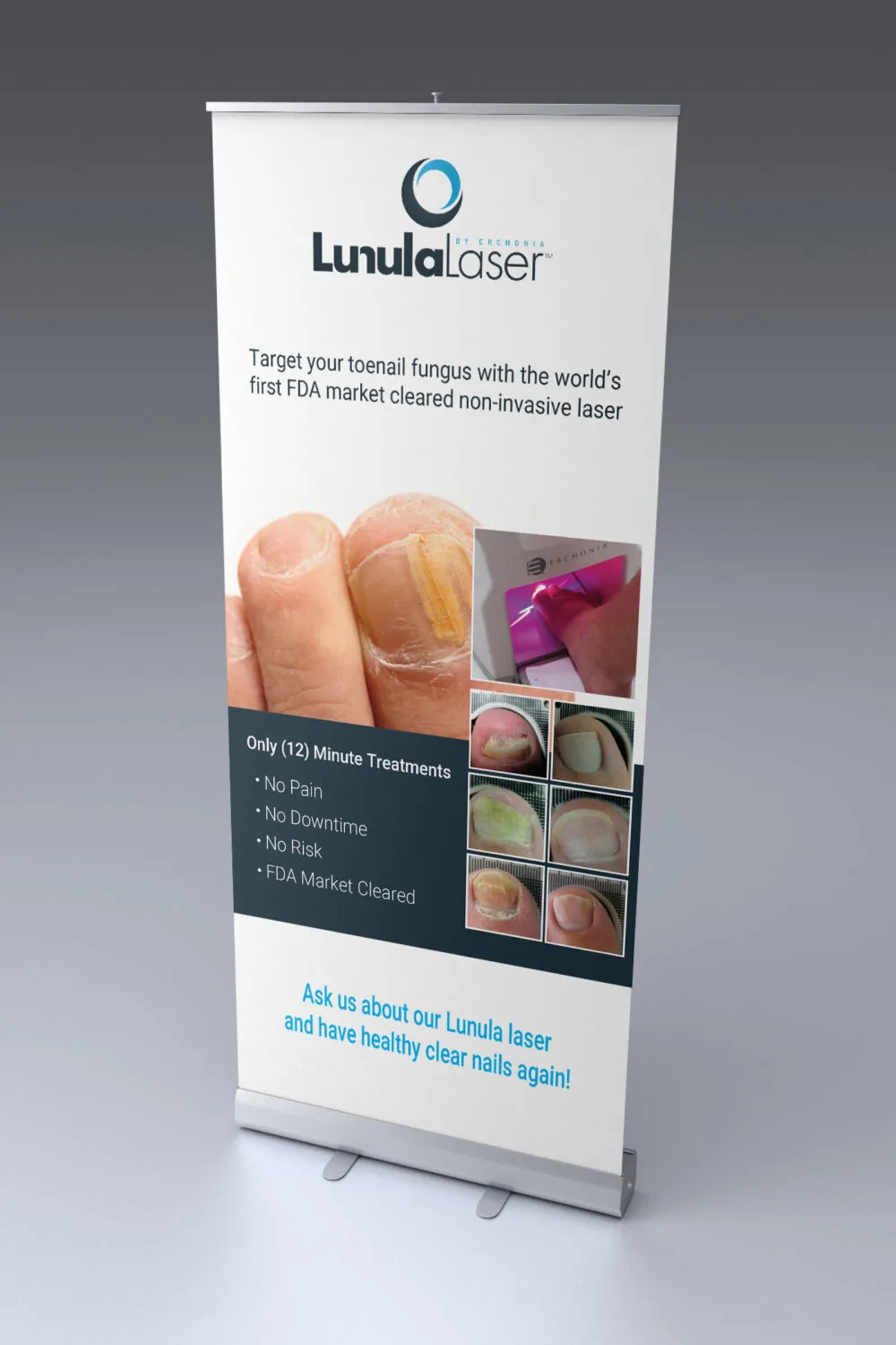 Pull-up-Banner_Lunula_04