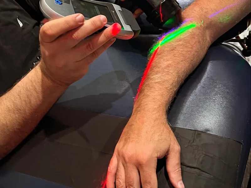 Hand and wrist