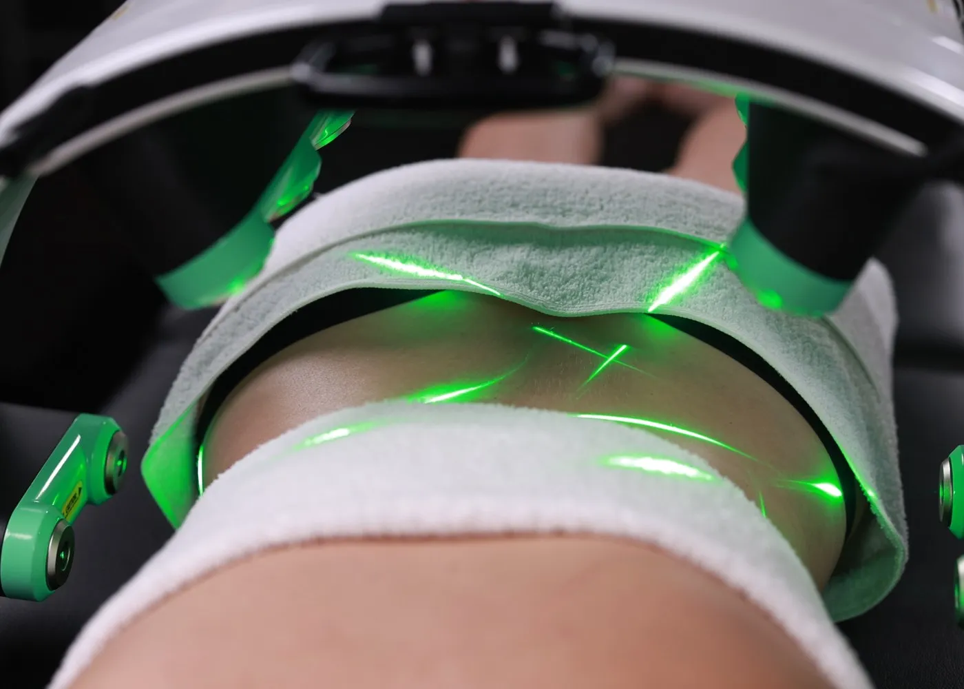 A patient during an Emerald laser session
