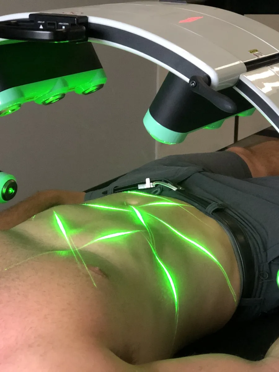 An Emerald laser session in a clinic
