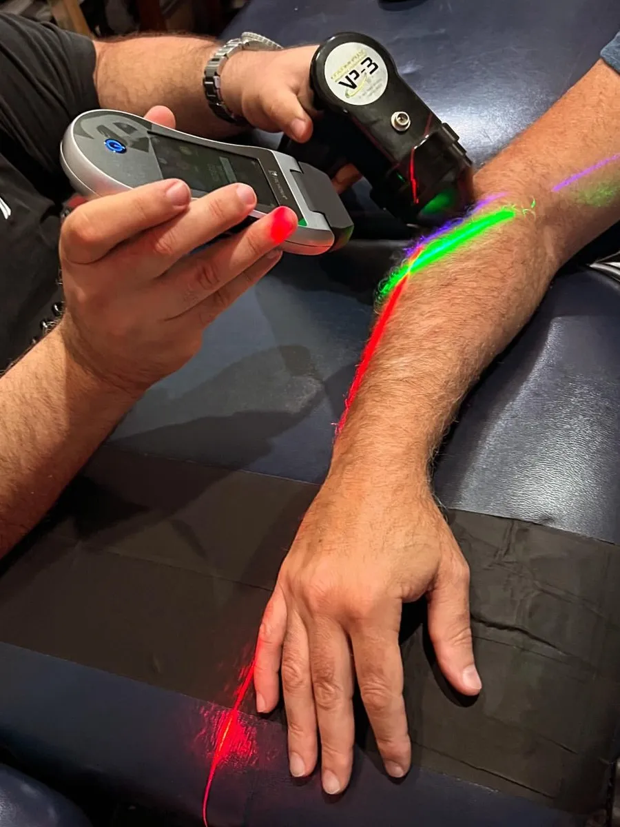A handheld Erchonia laser applied to a patient’s forearm on the table