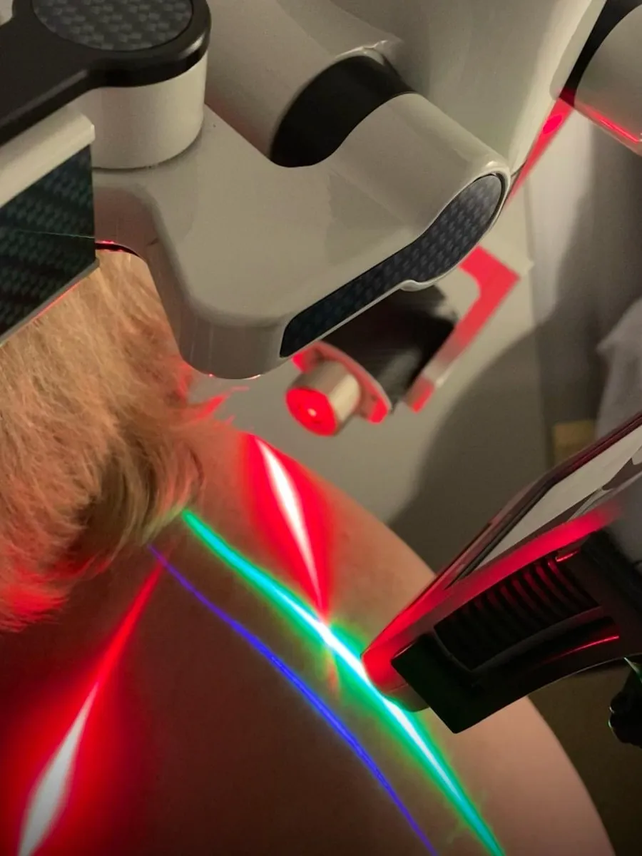 An Erchonia handheld laser on a flex-arm stand in a treatment room