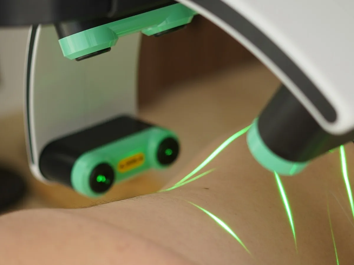 A patient under the Emerald laser in a weight-loss clinic